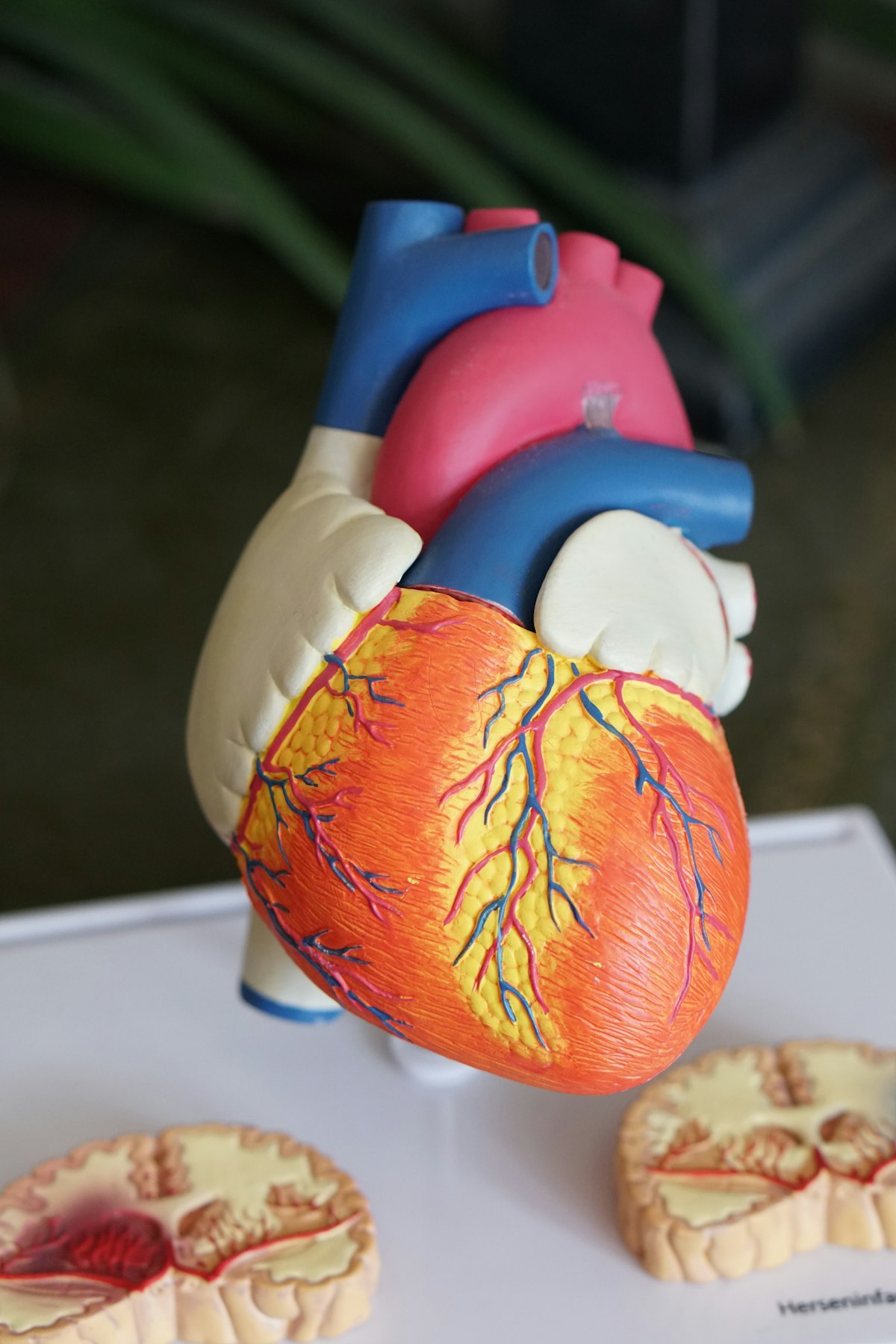 Anatomical heart model used in cardiac consultation